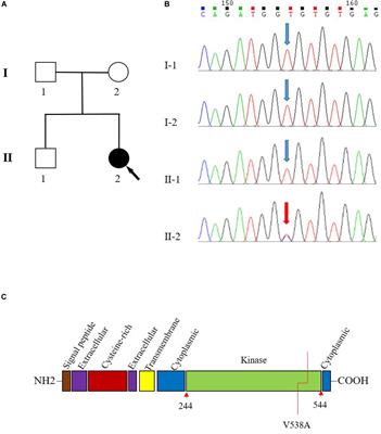 Identification of a Pathogenic TGFBR2 Variant in a Patient With Loeys–Dietz Syndrome